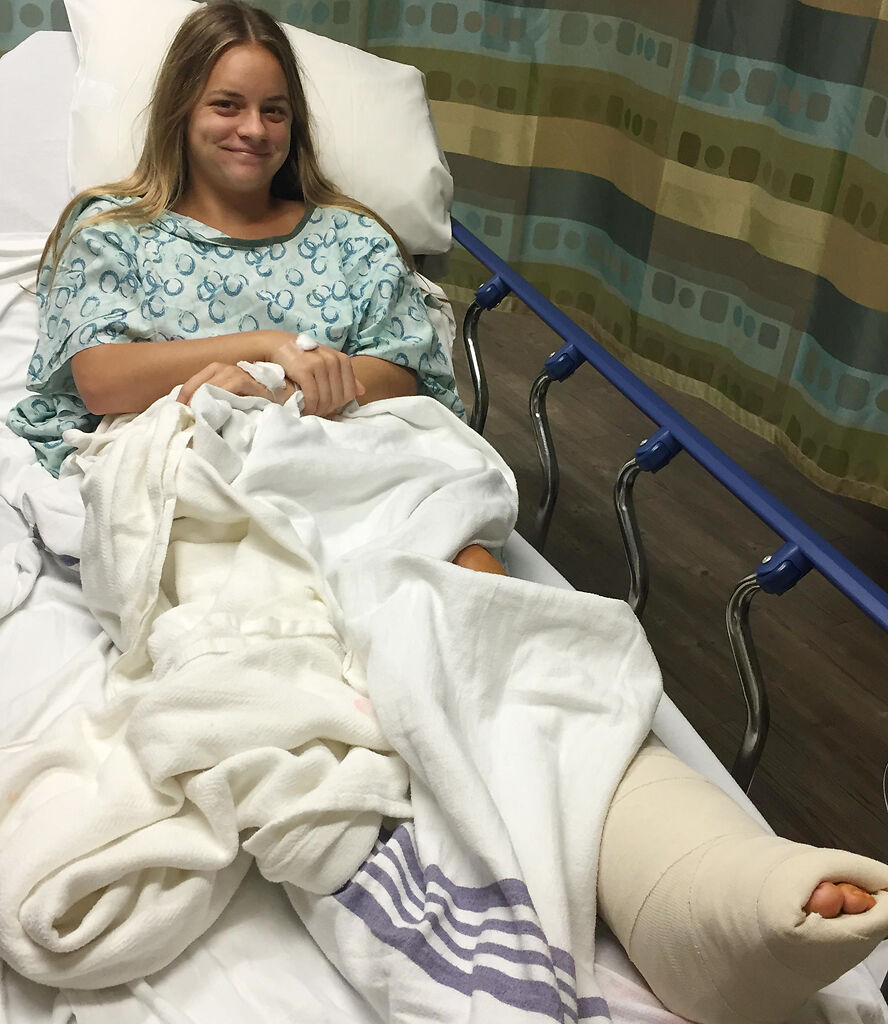 Former MU tennis player Turner Yates recovers from ankle surgery
